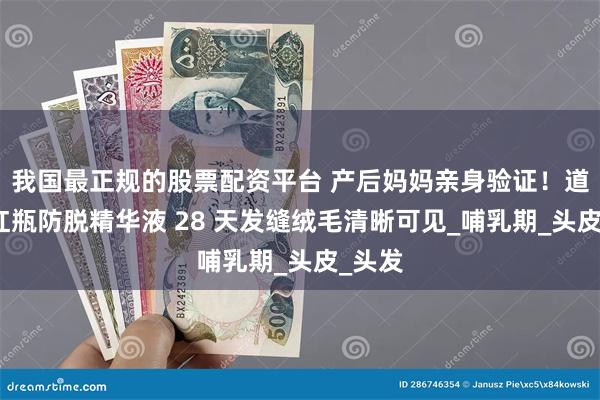 我国最正规的股票配资平台 产后妈妈亲身验证！道和小红瓶防脱精华液 28 天发缝绒毛清晰可见_哺乳期_头皮_头发